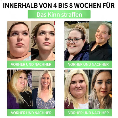 🇩🇪Berlin Health® 𝗚𝗟𝗣-𝟭 𝟖-𝗶𝗻-𝟭 Gesundheitslösung zum Einnehmen (nur einmal täglich, sichtbare Veränderungen in 7 Tagen) ✅ Bei Fettleibigkeit, Herz-Kreislauf-Gesundheit, Diabetes, Schlafapnoe, Darmgesundheit, Gelenkproblemen und mehr