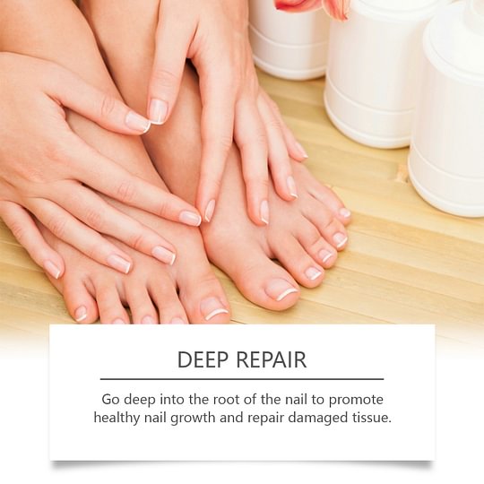 XIMONTH Fungus Pen - UNDECYLENIC ACID 25% - Daily Solution for Brittle & Thickened Nails-XDX