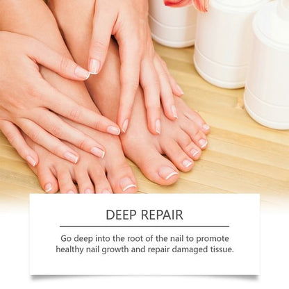 XIMONTH Fungus Pen - UNDECYLENIC ACID 25% - Daily Solution for Brittle & Thickened Nails-XDX