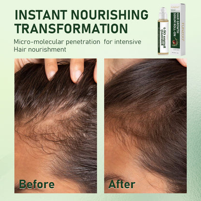 Funzoo® Batana Oil & Rosemary Hair Growth Roll-On Serum